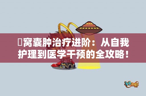 腘窝囊肿治疗进阶：从自我护理到医学干预的全攻略！